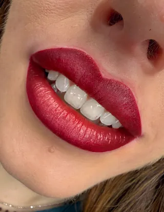 Trucco permanente labbra — foto 11 di 24