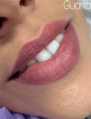 Trucco permanente labbra — foto 12 di 24