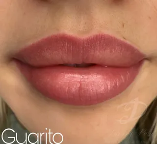 Trucco permanente labbra — foto 13 di 24
