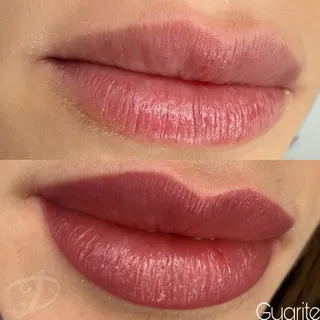 Trucco permanente labbra — foto 9 di 24