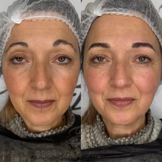 Trucco permanente sopracciglia sfumate — foto 9 di 18