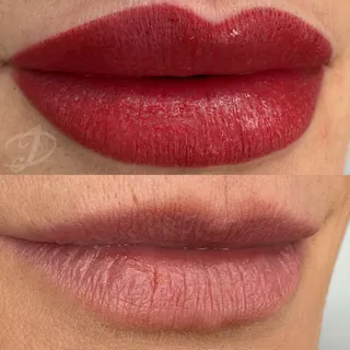 Trucco permanente labbra — foto 20 di 24