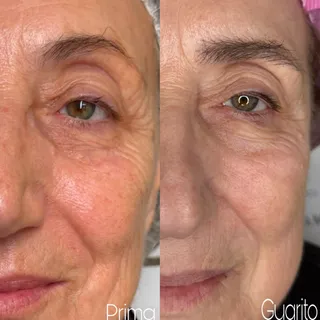 Trucco permanente occhi — foto 30 di 31