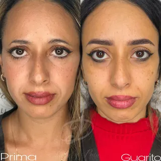 Trucco permanente occhi — foto 31 di 31
