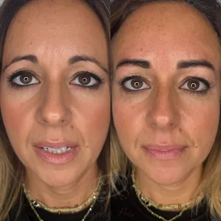 Trucco permanente sopracciglia realistiche — foto 1 di 4